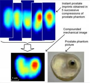 Real-time reconstruction of a 2-D image of a prostate phantom 